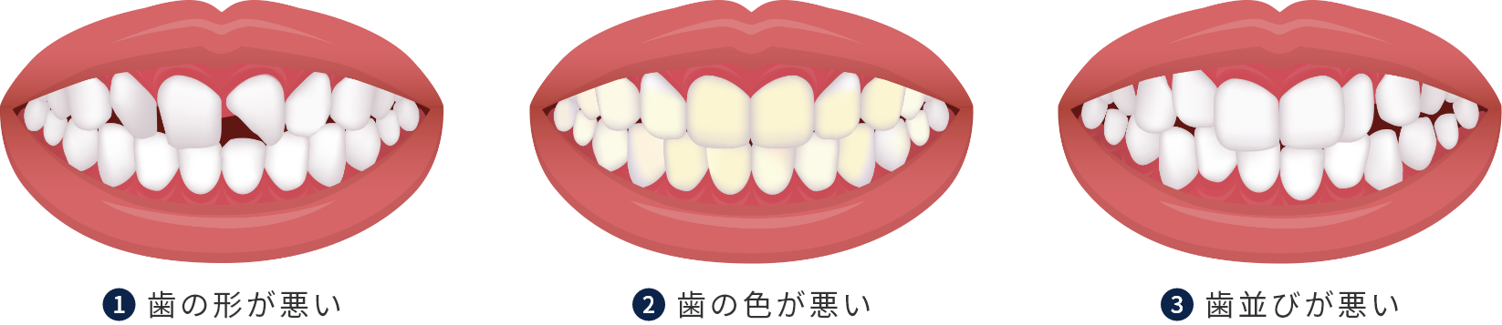 審美治療を受けられる主な患者さんの症状
