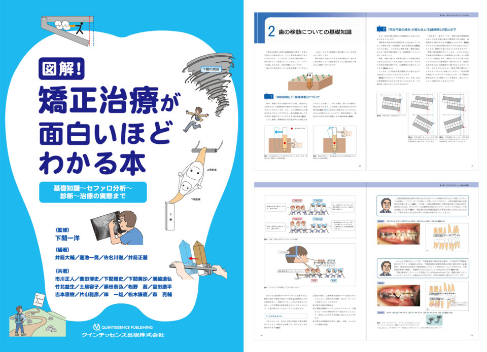 図解!矯正治療が面白いほどわかる本 : 基礎知識-セファロ分析-診断